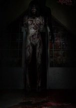 Allison Road